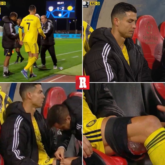 KAIYUN-美媒：C罗可能是腿筋受伤，若情况属实或影响他参加3月国家队比赛